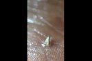 Guy Removes Crazy Long Splinter From His Foot