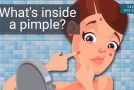 What Are The Constituents Of A Pimple?