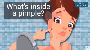 What Are The Constituents Of A Pimple?