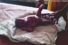 Miracle of God – Baby Born With Four Legs in India