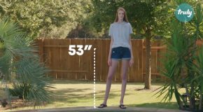 Girl Has The World’s Longest Legs 53 inches