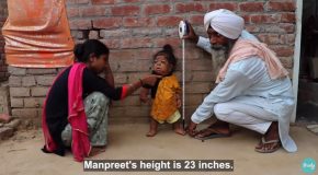 Manpreet Singh, The 26-Year-Old Man Who’s Trapped In A Toddler’s Body