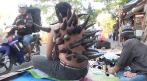 Unique Fire Cupping Therapy With Buffalo Horns In Indonesia!