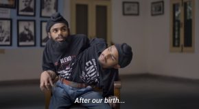 Conjoined Twins Share One Body But Two Heads