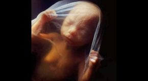 Real Photographs Of A Human Fetus Developing Inside The Womb