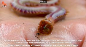 Can Bloodworms Bite Humans?