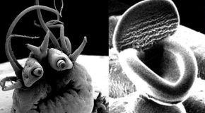 Taking A Look At Items Under An Electron Microscope